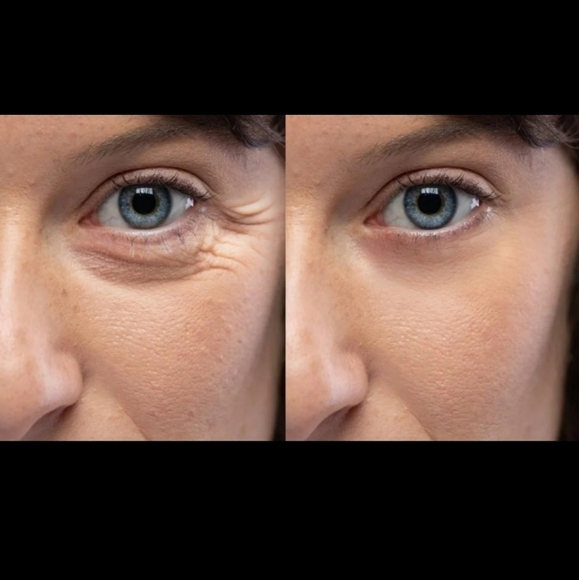 Mudmasky Vitamin Infused Eye Serum▪︎1 fl oz - Picture 4 of 8